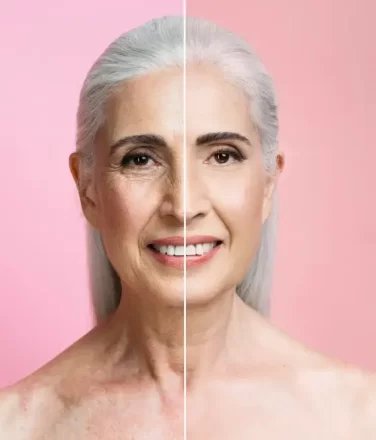 Anti-Aging Anti-Pigmentation