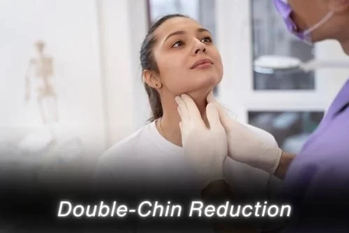Double-Chin Reduction